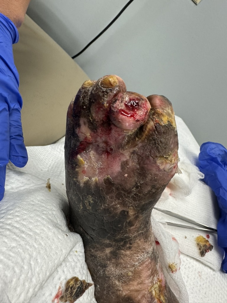 Wound Missions International mission photo
